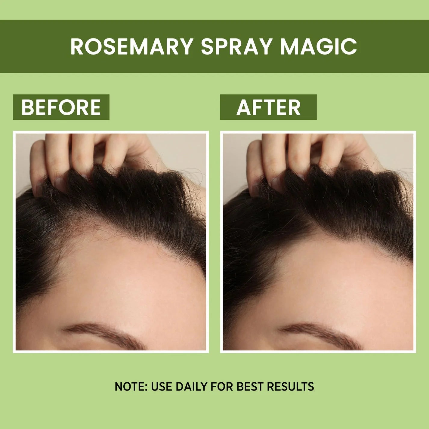 Rosemary Water, Hair Spray For Regrowth (BUY 1 GET 1 FREE)